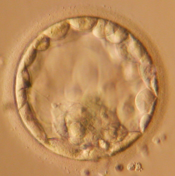 blastocyst_big.JPG