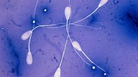 "Семейные трусы" и качество спермы: что общего?