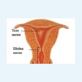Цервикальный канал матки и проблемы с зачатием