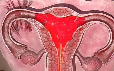 Симптомы, сопровождающие скудные менструации